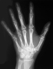 cor0070
